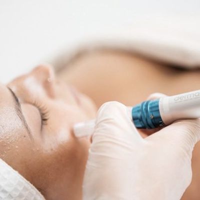 Micro-Needling/Collagen Induction Therapy Treatment